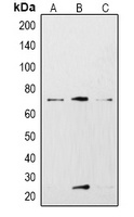 KCNN2 Antibody