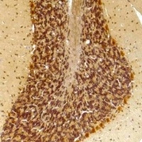 Anti-KCNN2 Antibody
