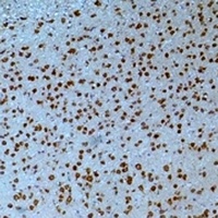 Anti-Kv8.2 Antibody