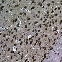 Anti-LC3B Antibody