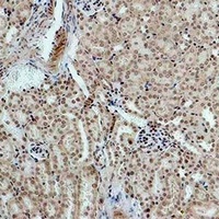 Anti-MAS Antibody