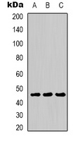 MKK1 Rabbit Polyclonal Antibody