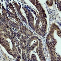 MKK1 Rabbit Polyclonal Antibody