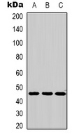 MKK2 Rabbit Polyclonal Antibody
