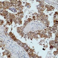 Anti-MKK2 Antibody