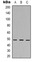 MKK5 Rabbit Polyclonal Antibody