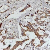 Anti-MKK5 Antibody