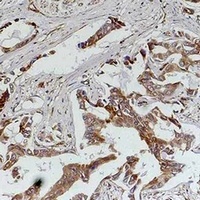 MKK5 antibody