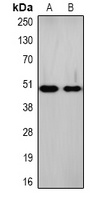 Na+/K+-ATPase beta1 Rabbit Polyclonal Antibody