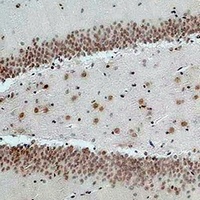 Anti-NMBR Antibody