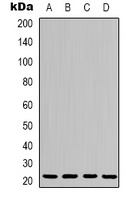 p21 Rabbit Polyclonal Antibody