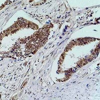p21 Rabbit Polyclonal Antibody