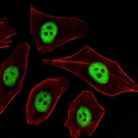 p21 Rabbit Polyclonal Antibody