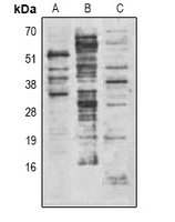 Methyl-Lysine Rabbit Polyclonal Antibody
