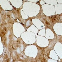 Methyl Lysine antibody