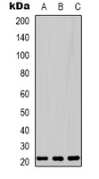Peroxiredoxin 1 Rabbit Polyclonal Antibody