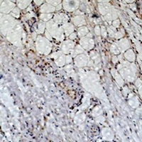 Anti-Peroxiredoxin 1 Antibody