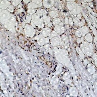 Peroxiredoxin 1 antibody