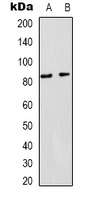 PI3K p85 alpha Rabbit Polyclonal Antibody