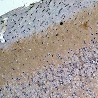 Anti-S100-A1 Antibody