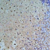 Anti-S100-B Antibody