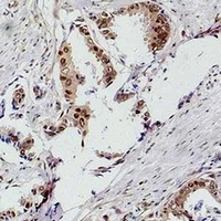 Anti-S6K1 Antibody