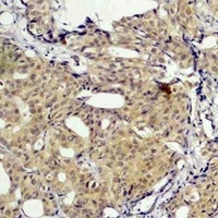 Anti-SLUG Antibody