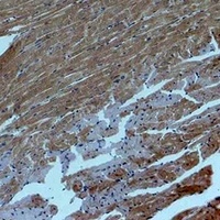 SMAD2 Rabbit Polyclonal Antibody