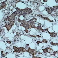 SMAD3 Rabbit Polyclonal Antibody