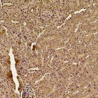 Anti-SOD1 Antibody