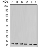 SOD2 Antibody