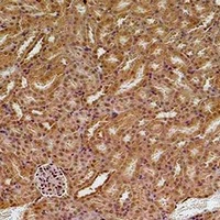 SOD2 Antibody