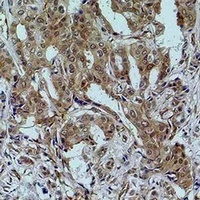 STAT3 Rabbit Polyclonal Antibody