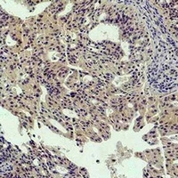 STAT5A Rabbit Polyclonal Antibody