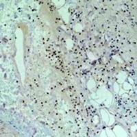 STAT5B Rabbit Polyclonal Antibody