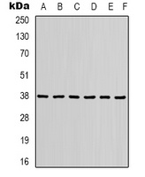 TBP Rabbit Polyclonal Antibody