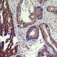 TBP Rabbit Polyclonal Antibody