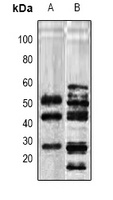 TGF beta 1 Rabbit Polyclonal Antibody