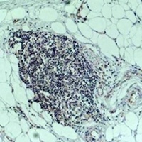 Anti-TNF alpha Antibody