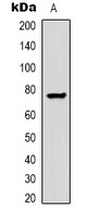 Transferrin Rabbit Polyclonal Antibody