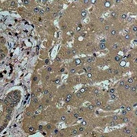 Transferrin Rabbit Polyclonal Antibody