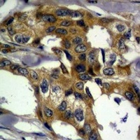 Anti-Vimentin Antibody
