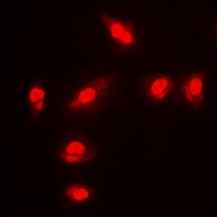 Anti-FOXO1 (Phospho-S256) Antibody