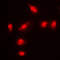 FOXO1 (phospho-S256) antibody