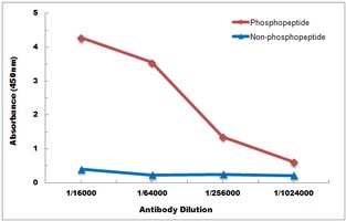Anti-FOXO1 (Phospho-S256) Antibody