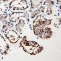 Factor XII HC antibody