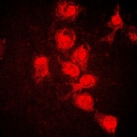 STAT1 (phospho-Y701) antibody