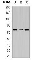 Estrogen Receptor alpha (Phospho-S104) Rabbit Polyclonal Antibody