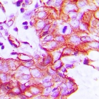 EGFR Antibody