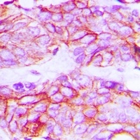 Anti-VEGFR2 (Phospho-Y1214) Antibody